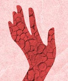 Got Itchy Skin? Here's What Might Be Causing It