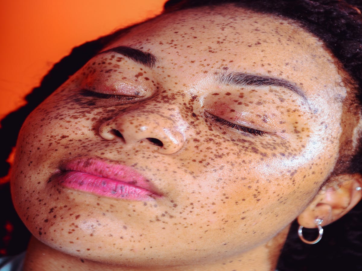 Dr. Pimple Popper Just Went Where She's Never Gone Before