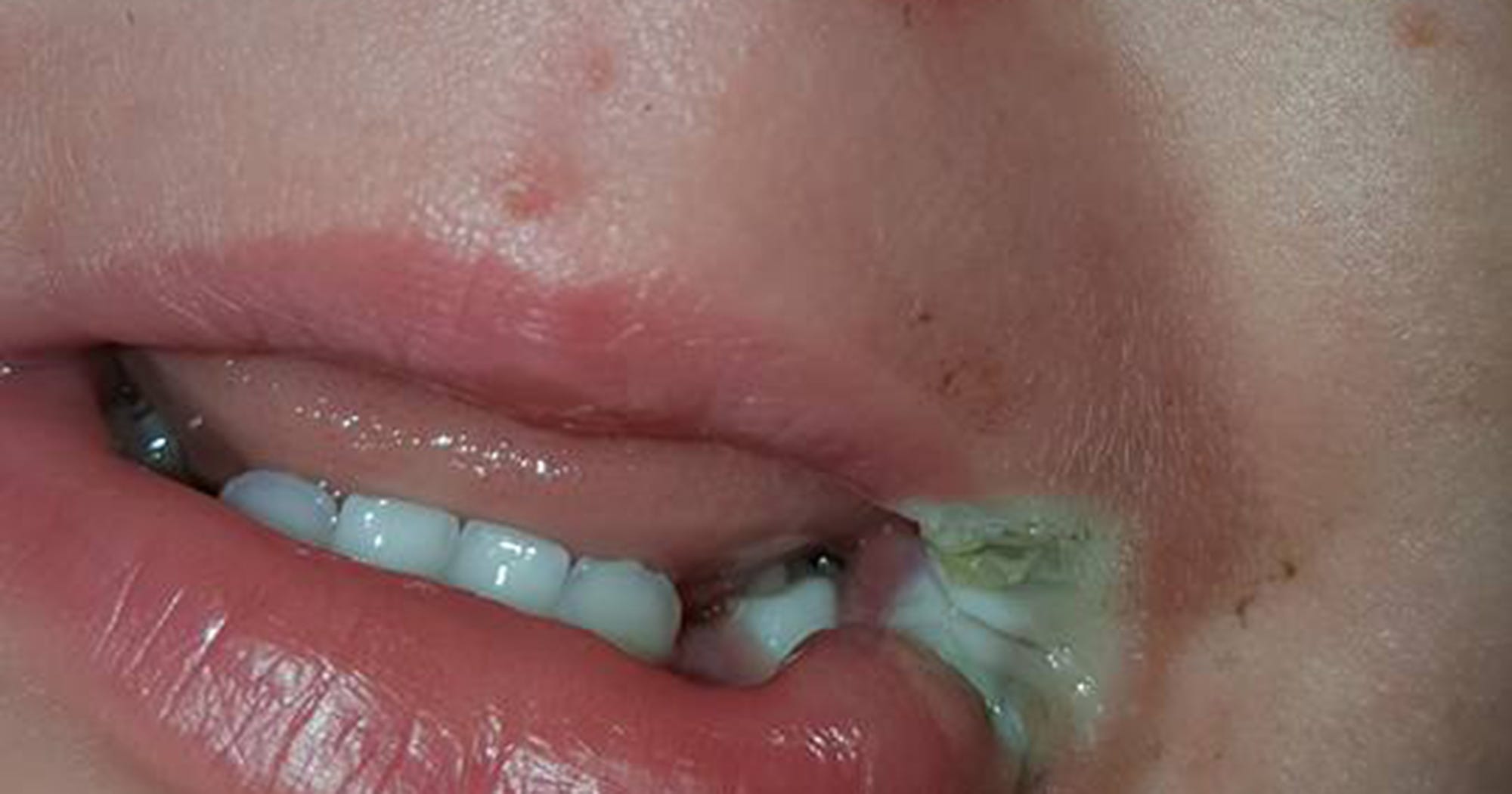 Baby Electrical Burn Mouth Dangerous Cell Phone Charger