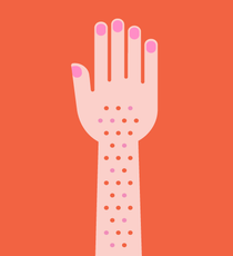 SunAllergies_Opener_MaryGalloway