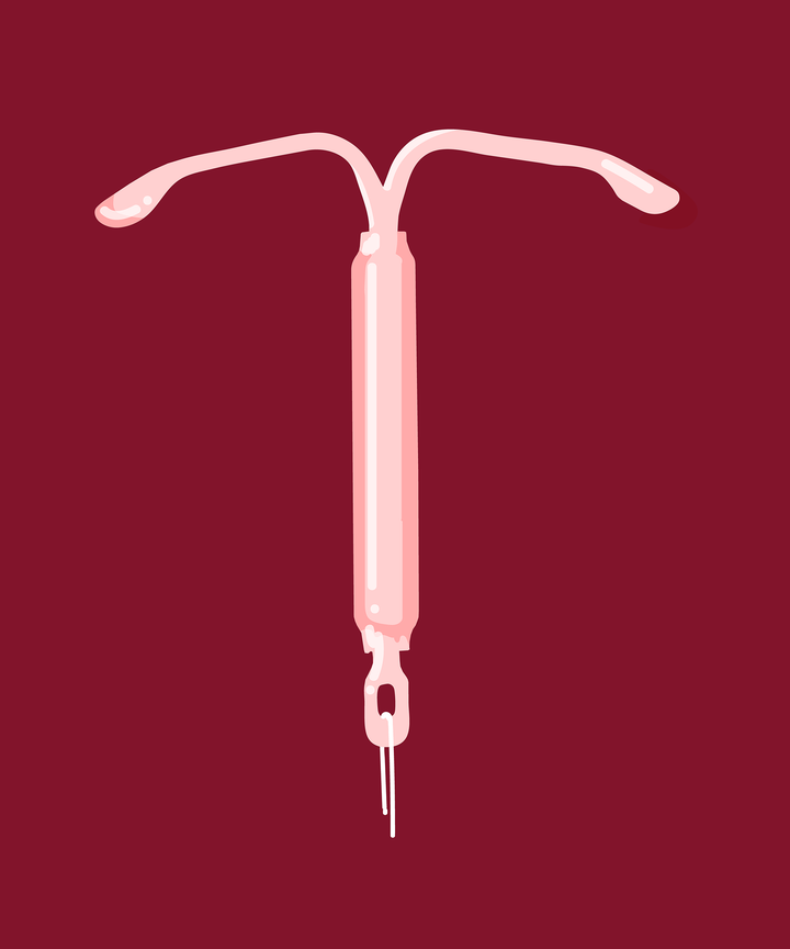 What Happens After You Get Your Iud Out What Happens After You Get Your Iud Out