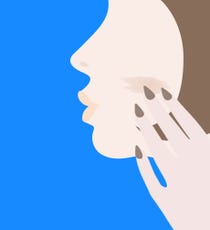 conceal_red_marks_opener3_anna