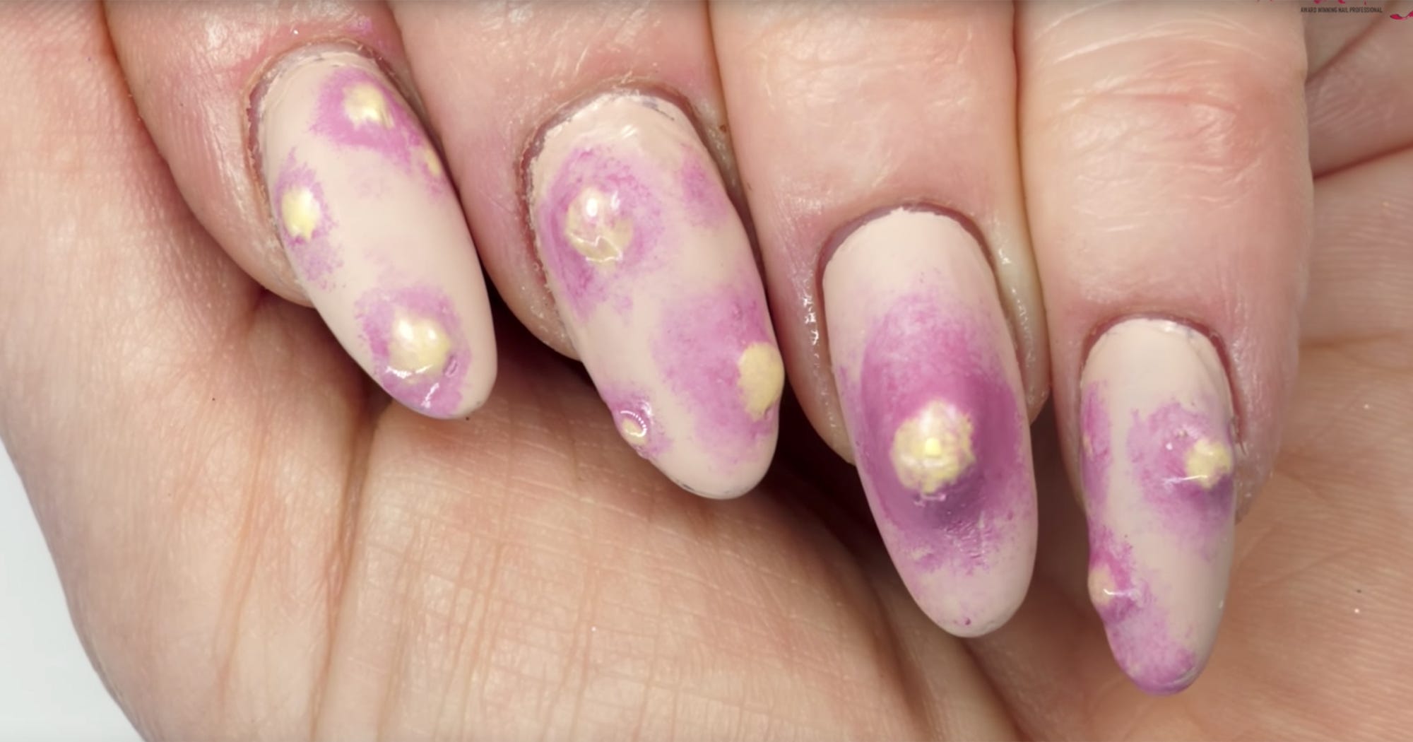 Pimple Popping Gross Nail Art Tutorial