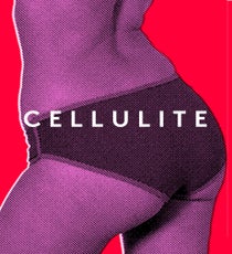 Cellulite_460x552