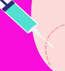 Botox_Confessions_Shawna_X-03