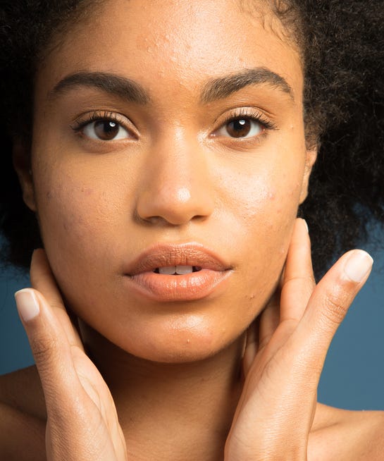 The Best Elf Makeup Acne Fighting Foundation Dupes