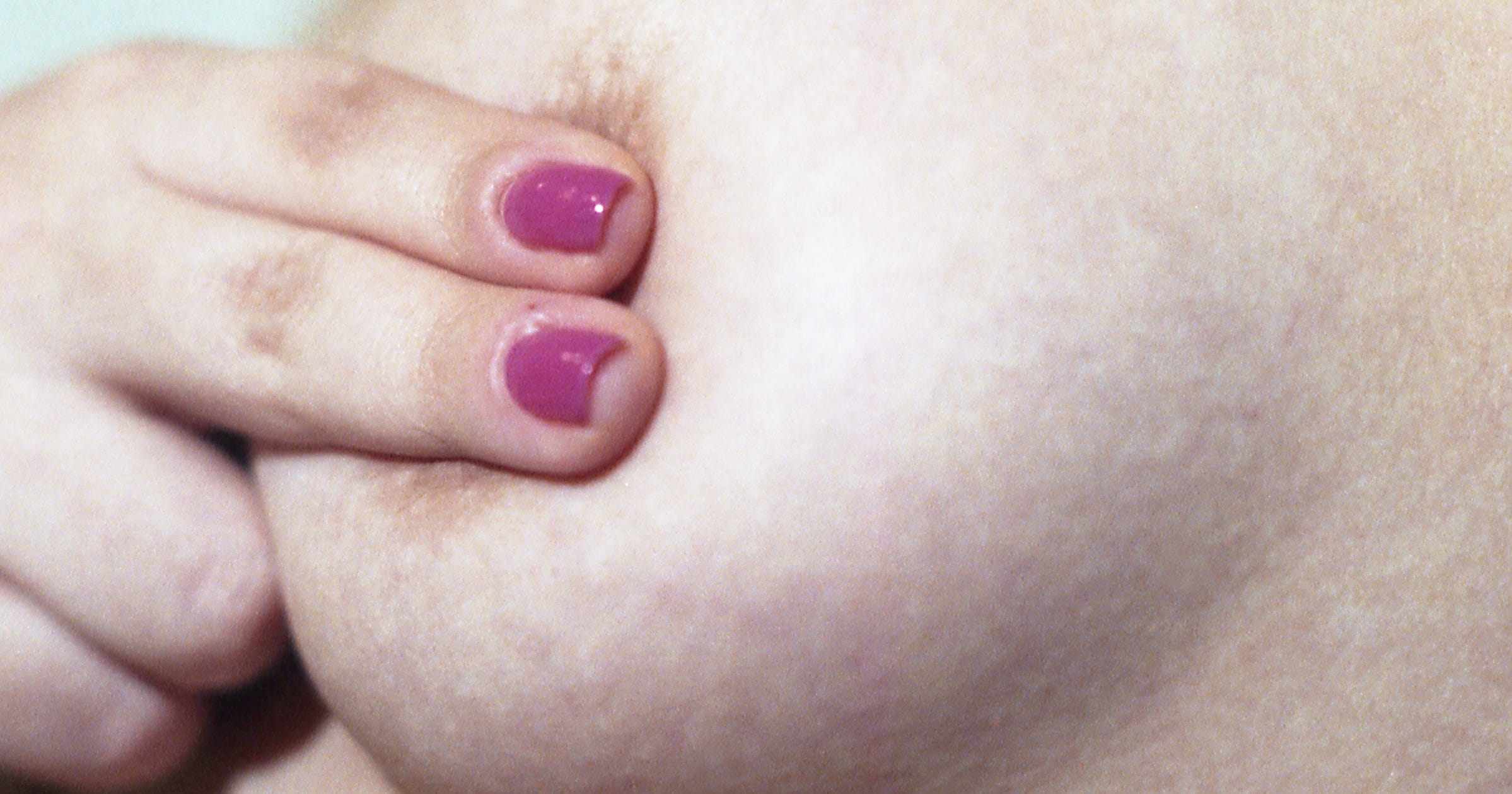 why do i have big areolas why do i have big areolas