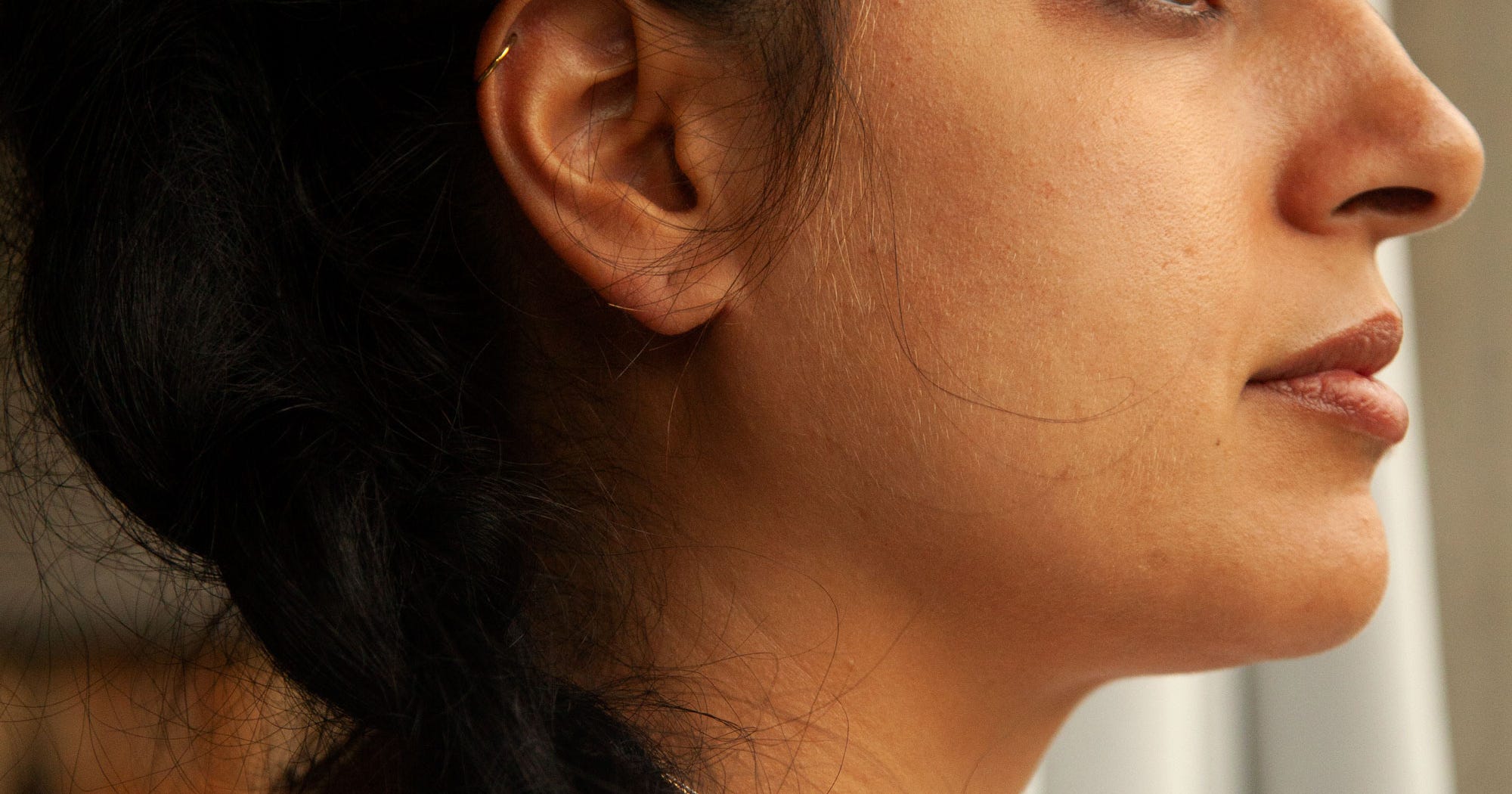 Vitamin C Skincare Benefits Pigmentation, Brightening