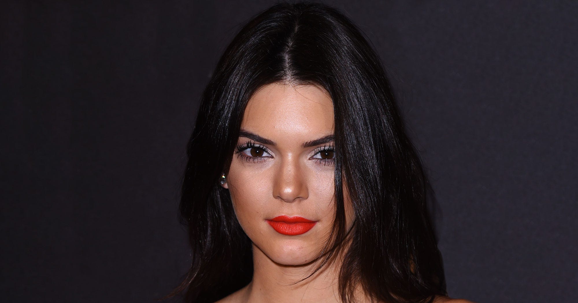 Kendall Jenner Acne Struggle